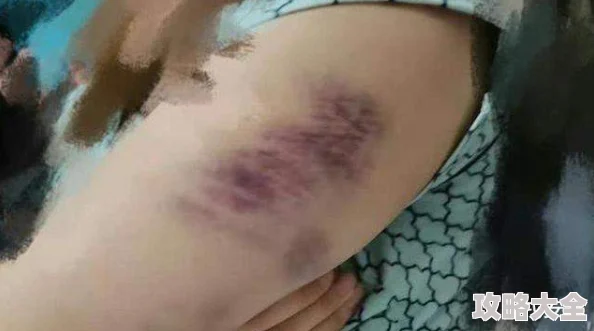 女同残忍调教女同曝光网络暴力呼吁关注受害者并停止传播相关视频
